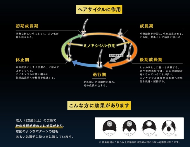 フィンジア「ミノキシジルローション5」の効果