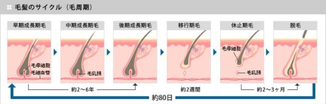 ヘアサイクル ,発毛剤,女性,ランキング