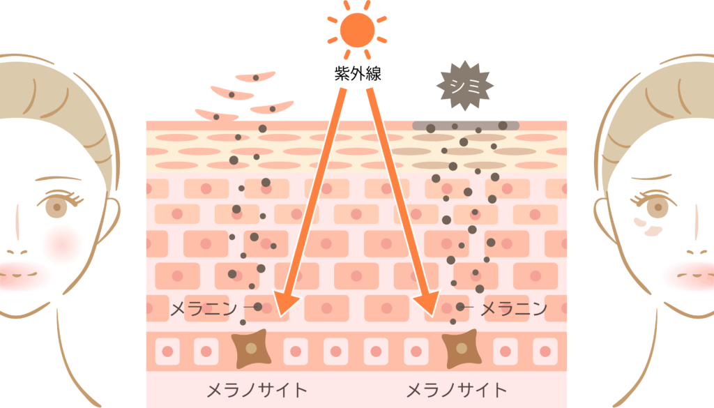 メラニンによってシミができる仕組み