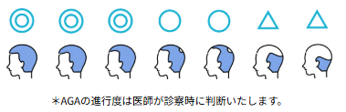 レバクリ,口コミ,治療プラン,デュタステリド＋ミノキシジル