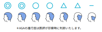レバクリ,口コミ,治療プラン,フィナステリド
