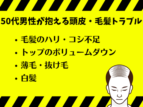 50代男性が抱える頭皮・毛髪トラブル