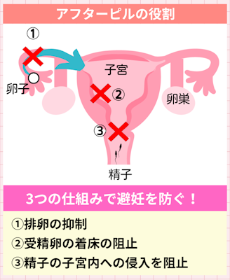 アフターピルの役割