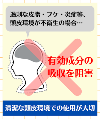 リデン育毛剤,効果なし,原因