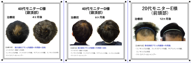 べアAGAクリニック,症例
