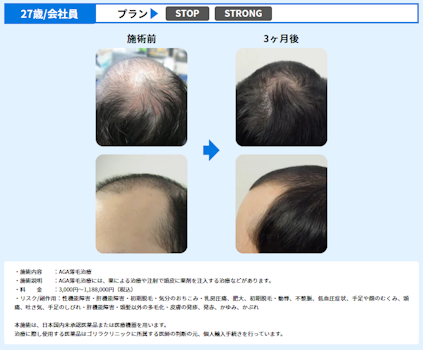 ゴリラクリニック,症例