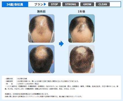 ゴリラクリニック,症例③