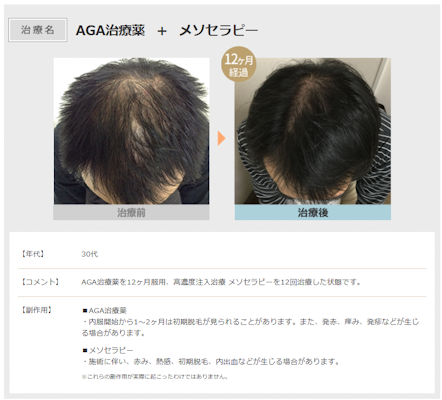 スマイルAGAクリニック,症例