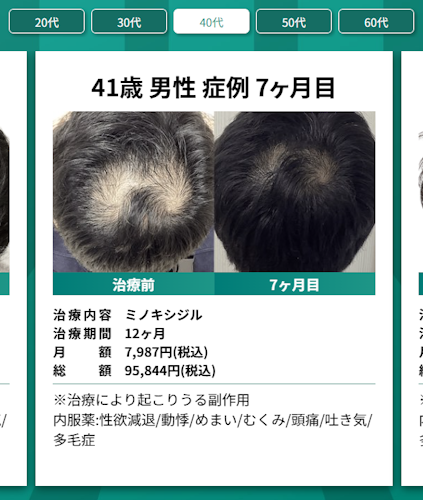 Dr.AGAクリニック池袋院,症例