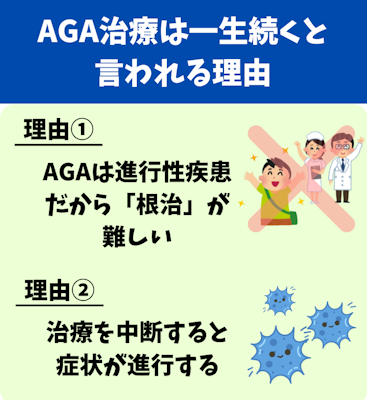 AGA治療,一生,理由