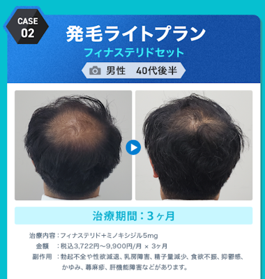 DMMオンラインクリニック,症例