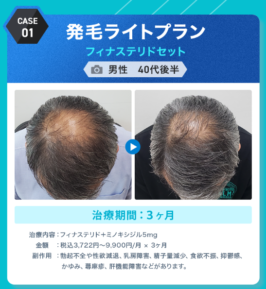 DMMオンラインクリニック,症例