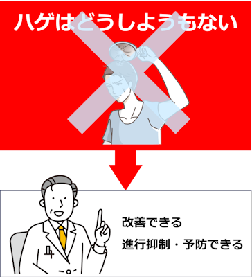 はげ,どうしようもない