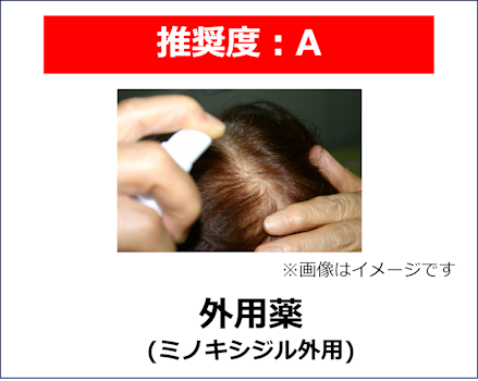 はげ,どうしようもない,外用薬