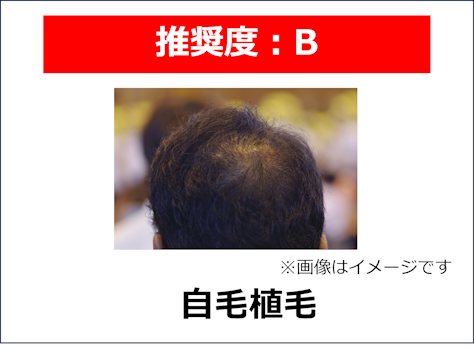 はげ,どうしようもない,植毛