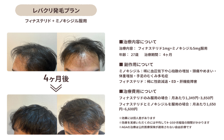 レバクリ,症例 