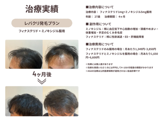 レバクリ,症例