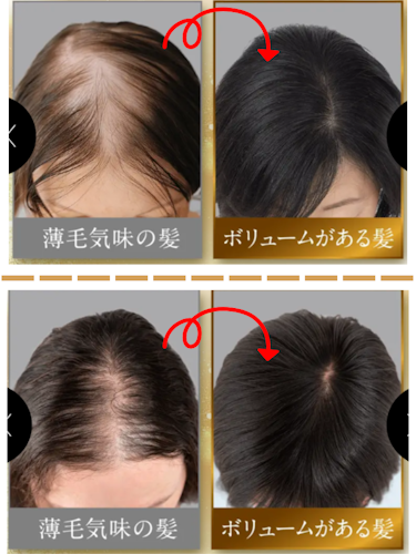 薬用リリィジュRICH,口コミ,効果