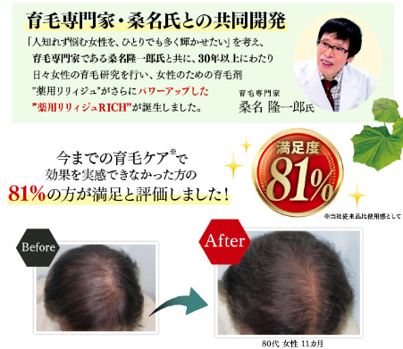 薬用リリィジュRICH,口コミ,育毛専門家と共同開発